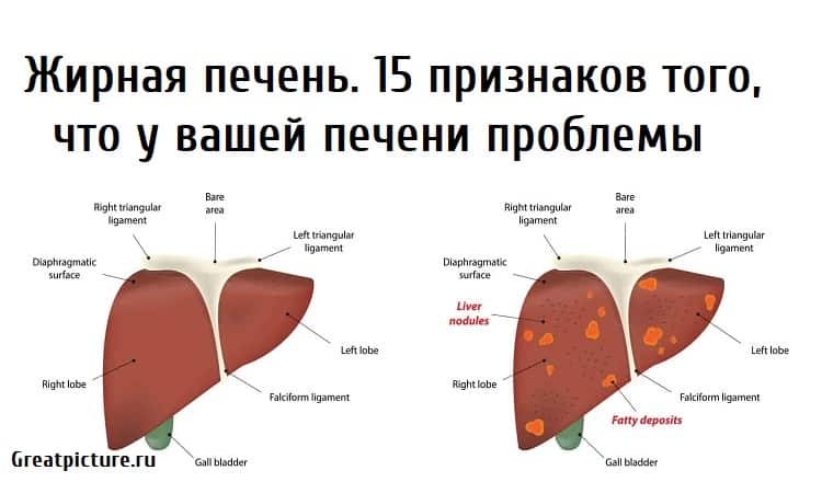 10 признаков нездоровой щитовидной железы - кгбуз горбольница №12
